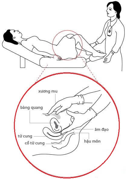 Khám vùng chậu- Một trong những phương pháp chuẩn đoán nguyên nhân sảy thai sớm liên tiếp chính xác 